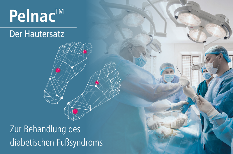 Pelnac der Hautersatz